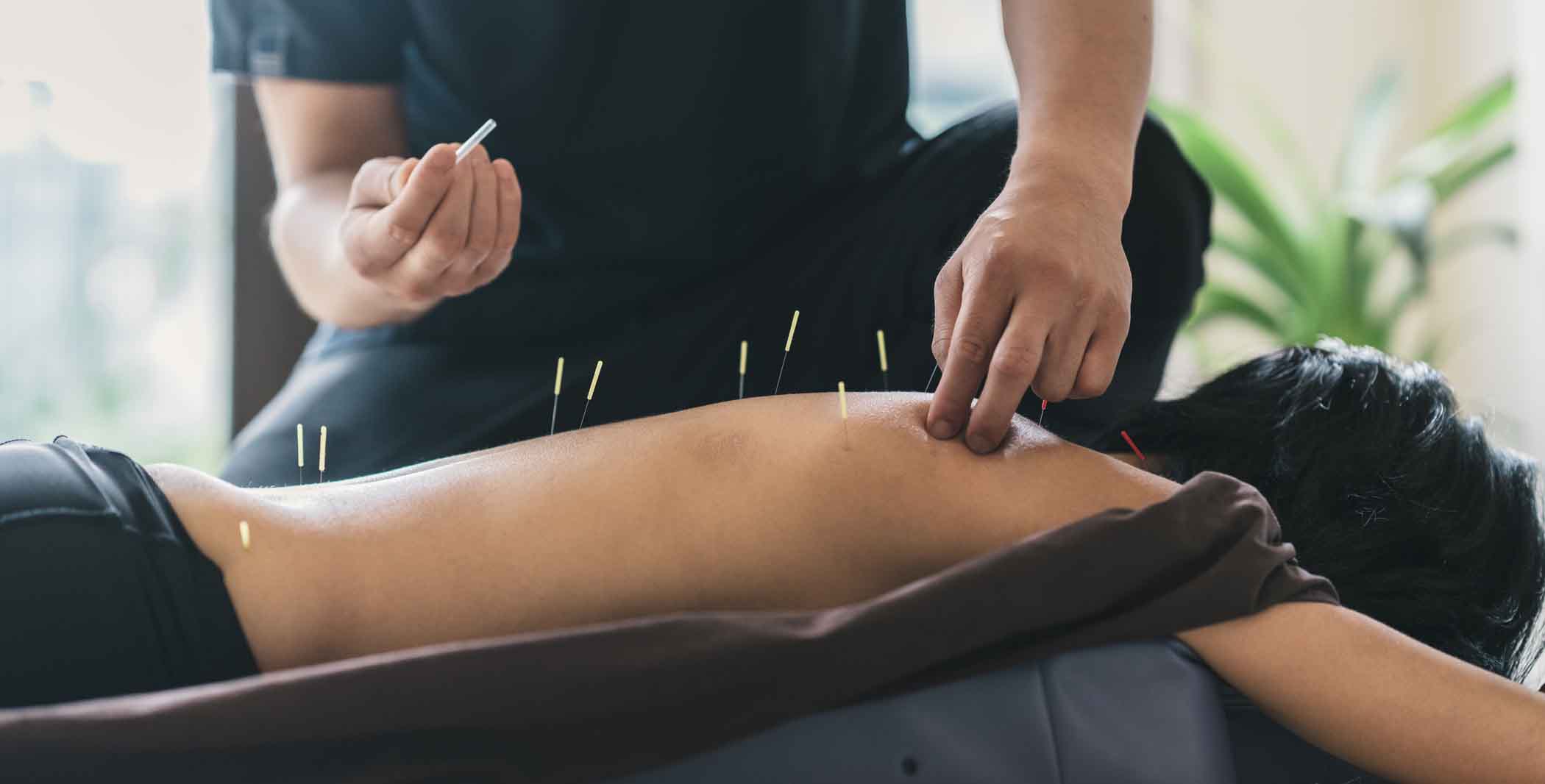 health insurance coverage of acupuncture